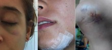 Universitárias são assediadas e agredidas em república de Ouro Preto após rejeitarem agressor